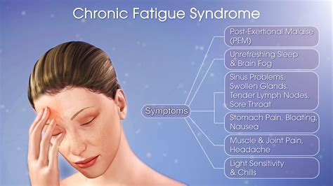 chronic fatigue syndrome dating